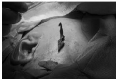 <strong>煜星代理_餐刀刺进面部6.5厘米深 医生</strong>